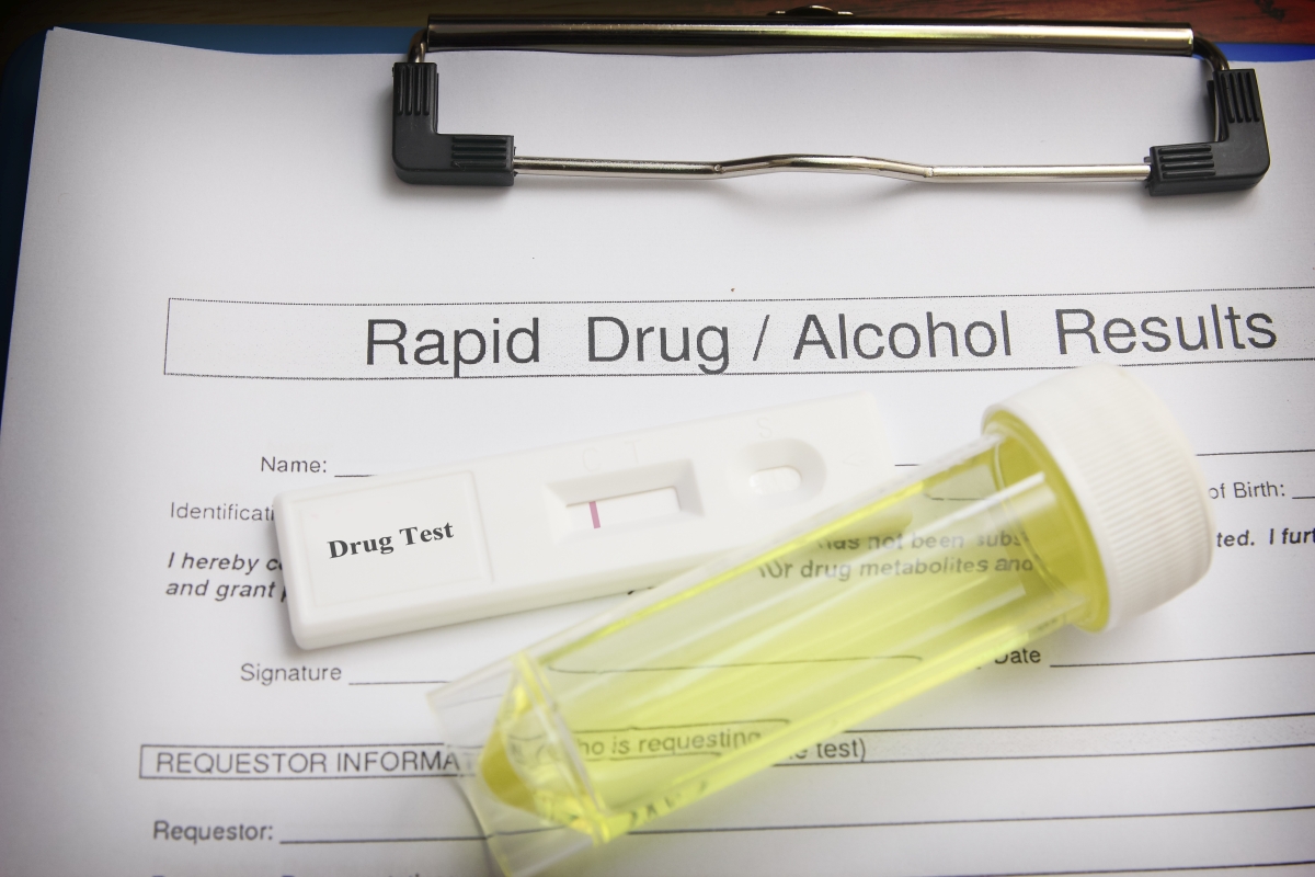 How to pass a drug test for my job