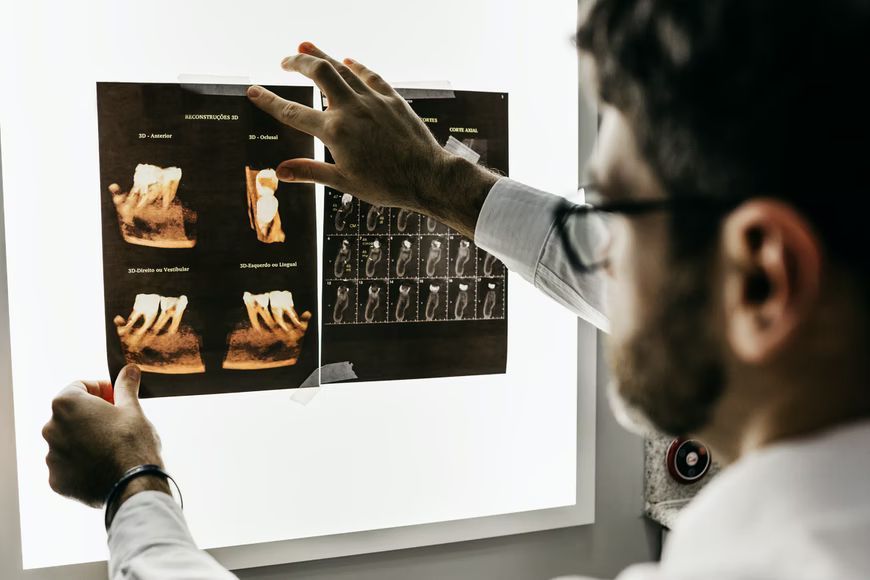 doctor looking at xrays